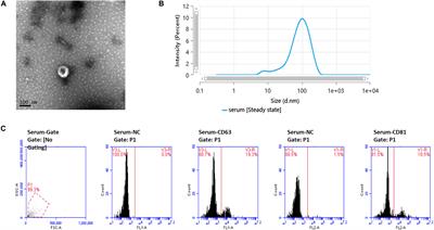 Serum Exosomal Circular RNA Expression Profile and Regulative Role in Proliferative Diabetic Retinopathy